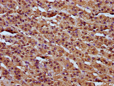 IHC image of RCN3 Antibody diluted at 1:200 and staining in paraffin-embedded human adrenal gland tissue performed on a Leica BondTM system. After dewaxing and hydration, antigen retrieval was mediated by high pressure in a citrate buffer (pH 6.0). Section was blocked with 10% normal goat serum 30min at RT. Then primary antibody (1% BSA) was incubated at 4°C overnight. The primary is detected by a biotinylated secondary antibody and visualized using an HRP conjugated SP system.Rabbit anti-Human RCN3 Polyclonal Antibody