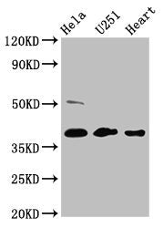 Western Blot  | Positive WB detected in: Hela whole cell lysate, U251 whole cell lysate, Mouse heart tissue  | All lanes: RCN3 antibody at 4.6µg/ml  | Secondary  | Goat polyclonal to rabbit IgG at 1/50000 dilution  | Predicted band size: 38 kDa  | Observed band size: 38 kDaRabbit anti-Human RCN3 Polyclonal Antibody