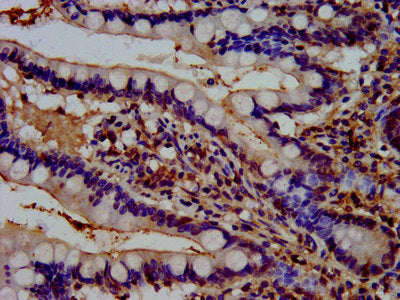 IHC image of REPS1 Antibody diluted at 1:500 and staining in paraffin-embedded human small intestine tissue performed on a Leica BondTM system. After dewaxing and hydration, antigen retrieval was mediated by high pressure in a citrate buffer (pH 6.0). Section was blocked with 10% normal goat serum 30min at RT. Then primary antibody (1% BSA) was incubated at 4°C overnight. The primary is detected by a biotinylated secondary antibody and visualized using an HRP conjugated SP system.Rabbit anti-Human REPS1 Polyclonal Antibody