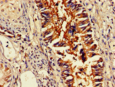 IHC image of OMA1 Antibody diluted at 1:400 and staining in paraffin-embedded human lung tissue performed on a Leica BondTM system. After dewaxing and hydration, antigen retrieval was mediated by high pressure in a citrate buffer (pH 6.0). Section was blocked with 10% normal goat serum 30min at RT. Then primary antibody (1% BSA) was incubated at 4°C overnight. The primary is detected by a biotinylated secondary antibody and visualized using an HRP conjugated SP system.Rabbit anti-Human OMA1 Polyclonal Antibody