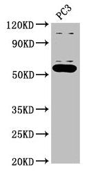 Western Blot  | Positive WB detected in: PC-3 whole cell lysate  | All lanes: OMA1 antibody at 2.7µg/ml  | Secondary  | Goat polyclonal to rabbit IgG at 1/50000 dilution  | Predicted band size: 61, 56 kDa  | Observed band size: 56 kDaRabbit anti-Human OMA1 Polyclonal Antibody