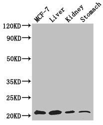 Western Blot | Positive WB detected in: MCF-7 whole cell lysate, Mouse liver tissue, Mouse kidney tissue, Mouse stomach tissue | All lanes: GNPNAT1 antibody at 3.4μg/ml | Secondary | Goat polyclonal to rabbit IgG at 1/50000 dilution | Predicted band size: 21 kDa | Observed band size: 21 kDaRabbit anti-Human GNPNAT1 Polyclonal Antibody