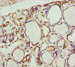 Immunohistochemistry of paraffin-embedded human thyroid tissue using SCRN2 Antibody at dilution of 1:100Rabbit anti-Human SCRN2 Polyclonal Antibody