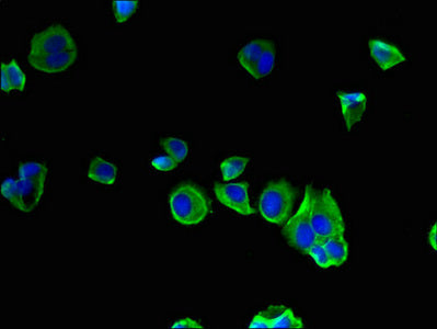 Immunofluorescent analysis of MCF-7 cells using the antibody at dilution of 1:100 and Alexa Fluor 488-congugated AffiniPure Goat Anti-Rabbit IgG(H+L)Rabbit anti-Human SEC22A Polyclonal Antibody