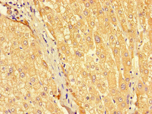 Immunohistochemistry of paraffin-embedded human liver tissue using SEC22A Antibody at dilution of 1:100Rabbit anti-Human SEC22A Polyclonal Antibody