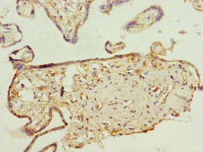 Immunohistochemistry of paraffin-embedded human placenta tissue using PLEKHA8 Antibody at dilution of 1:100Rabbit anti-Human PLEKHA8 Polyclonal Antibody