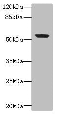 Western blot | All lanes: PLEKHA8 antibody at 0.8μg/ml + Mouse brain tissue | Secondary | Goat polyclonal to rabbit IgG at 1/10000 dilution | Predicted band size: 59, 52, 50 kDa | Observed band size: 59 kDaRabbit anti-Human PLEKHA8 Polyclonal Antibody
