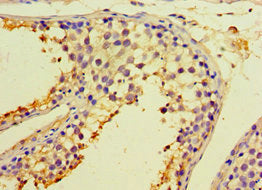 Immunohistochemistry of paraffin-embedded human testis tissue using CALR3 Antibody at dilution of 1:100