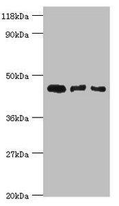 Western blot | All lanes: Calreticulin-3 antibody at 4μg/ml | Lane 1: Hela whole cell lysate | Lane 2: HepG2 whole cell lysate | Lane 3: Rat gonad tissue | Secondary | Goat polyclonal to rabbit IgG at 1/10000 dilution | Predicted band size: 45 kDa | Observed band size: 45 kDa