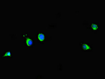 Immunofluorescent analysis of Hela cells using PRMT6 Antibody at dilution of 1:100 and Alexa Fluor 488-congugated AffiniPure Goat Anti-Rabbit IgG(H+L)Rabbit anti-Human PRMT6 Polyclonal Antibody