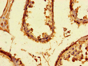 Immunohistochemistry of paraffin-embedded human testis tissue using the antibody at dilution of 1:100Rabbit anti-Human PRMT6 Polyclonal Antibody