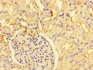 Immunohistochemistry of paraffin-embedded human kidney tissue using PRMT6 Antibody at dilution of 1:100Rabbit anti-Human PRMT6 Polyclonal Antibody