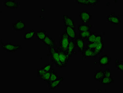 Immunofluorescent analysis of Hela cells using PRMT6 Antibody at dilution of 1:100 and Alexa Fluor 488-congugated AffiniPure Goat Anti-Rabbit IgG(H+L)Rabbit anti-Human PRMT6 Polyclonal Antibody
