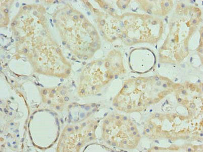 Immunohistochemistry of paraffin-embedded human kidney tissue using PRMT6 Antibody at dilution of 1:100Rabbit anti-Human PRMT6 Polyclonal Antibody
