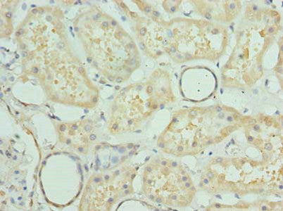 Immunohistochemistry of paraffin-embedded human kidney tissue using PRMT6 Antibody at dilution of 1:100Rabbit anti-Human PRMT6 Polyclonal Antibody