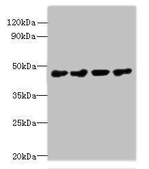 Western blot | All lanes: PRMT6 antibody at 0.4μg/ml | Lane 1: 293T whole cell lysate | Lane 2: MCF-7 whole cell lysate | Lane 3: A431 whole cell lysate | Lane 4: K562 whole cell lysate | Secondary | Goat polyclonal to rabbit IgG at 1/10000 dilution | Predicted band size: 42, 33 kDa | Observed band size: 42 kDaRabbit anti-Human PRMT6 Polyclonal Antibody