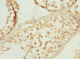 Immunohistochemistry of paraffin-embedded human testis tissue using PPP3R2 Antibody at dilution of 1:100Rabbit anti-Human PPP3R2 Polyclonal Antibody