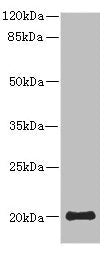 Western blot | All lanes: PPP3R2 antibody at 9.25μg/ml + Mouse brain tissue | Secondary | Goat polyclonal to rabbit IgG at 1/10000 dilution | Predicted band size: 20 kDa | Observed band size: 20 kDaRabbit anti-Human PPP3R2 Polyclonal Antibody
