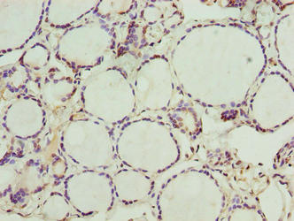 Immunohistochemistry of paraffin-embedded human thyroid tissue using NOL4L Antibody at dilution of 1:100Rabbit anti-Human NOL4L Polyclonal Antibody