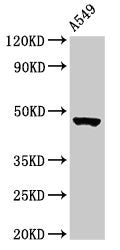 Western Blot  | Positive WB detected in: A549 whole cell lysate  | All lanes: NOL4L antibody at 3µg/ml  | Secondary  | Goat polyclonal to rabbit IgG at 1/50000 dilution  | Predicted band size: 48, 44 kDa  | Observed band size: 48 kDaRabbit anti-Human NOL4L Polyclonal Antibody