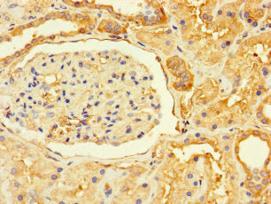 Immunohistochemistry of paraffin-embedded human kidney tissue using the antibody at dilution of 1:100Rabbit anti-Human GPR82 Polyclonal Antibody