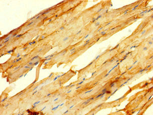Immunohistochemistry of paraffin-embedded human skeletal muscle tissue using GPR82 Antibody at dilution of 1:100Rabbit anti-Human GPR82 Polyclonal Antibody