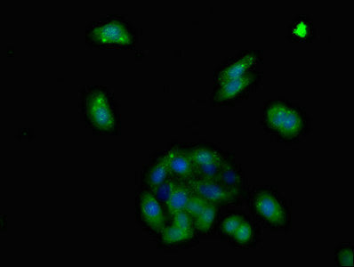Immunofluorescent analysis of HepG2 cells using ADGRA2 Antibody at dilution of 1:100 and Alexa Fluor 488-congugated AffiniPure Goat Anti-Rabbit IgG(H+L)Rabbit anti-Human ADGRA2 Polyclonal Antibody