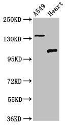 Western Blot | Positive WB detected in: A549 whole cell lysate, Rat heart tissue | All lanes: ADGRA2 antibody at 3μg/ml | Secondary | Goat polyclonal to rabbit IgG at 1/50000 dilution | Predicted band size: 143, 120, 20 kDa | Observed band size: 143, 120 kDa