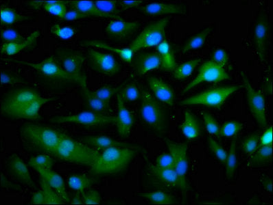 Immunofluorescence staining of U251 cells with PANX1 Antibody at 1:266, counter-stained with DAPI. The cells were fixed in 4% formaldehyde, permeabilized using 0.2% Triton X-100 and blocked in 10% normal Goat Serum. The cells were then incubated with the antibody overnight at 4°C. The secondary antibody was Alexa Fluor 488-congugated AffiniPure Goat Anti-Rabbit IgG(H+L).Rabbit anti-Human PANX1 Polyclonal Antibody