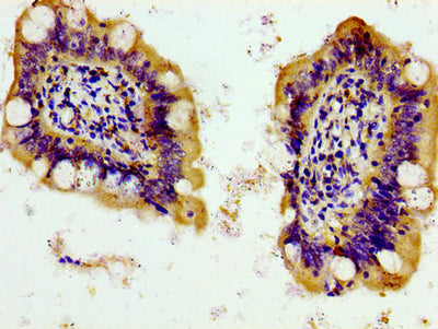 Immunohistochemistry of paraffin-embedded human small intestine tissue using PANX1 Antibody at dilution of 1:100Rabbit anti-Human PANX1 Polyclonal Antibody