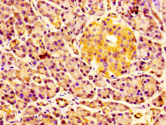 IHC image of ERGIC2 Antibody diluted at 1:100 and staining in paraffin-embedded human pancreatic tissue performed on a Leica BondTM system. After dewaxing and hydration, antigen retrieval was mediated by high pressure in a citrate buffer (pH 6.0). Section was blocked with 10% normal goat serum 30min at RT. Then primary antibody (1% BSA) was incubated at 4°C overnight. The primary is detected by a biotinylated secondary antibody and visualized using an HRP conjugated SP system.Rabbit anti-Human ERGIC2 Polyclonal Antibody