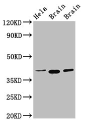 Western Blot  | Positive WB detected in: Hela whole cell lysate, Rat brain tissue, Mouse brain tissue  | All lanes: ERGIC2 antibody at 2.5µg/ml  | Secondary  | Goat polyclonal to rabbit IgG at 1/50000 dilution  | Predicted band size: 43 kDa  | Observed band size: 43 kDaRabbit anti-Human ERGIC2 Polyclonal Antibody