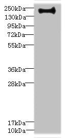 Western blot | All lanes: VSX1 antibody IgG at 0.87μg/ml + Hela whole cell lysate | Secondary | Goat polyclonal to rabbit IgG at 1/10000 dilution | Predicted band size: 159, 154, 153, 152, 151, 147, 160 kDa | Observed band size: 159 kDaRabbit anti-Human ERBIN Polyclonal Antibody