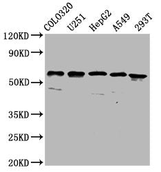 Western Blot  | Positive WB detected in: Colo320 whole cell lysate, U251 whole cell lysate, HepG2 whole cell lysate, A549 whole cell lysate, 293T whole cell lysate  | All lanes: CLCC1 antibody at 3.7µg/ml  | Secondary  | Goat polyclonal to rabbit IgG at 1/50000 dilution  | Predicted band size: 63, 57, 48, 40 kDa  | Observed band size: 63 kDaRabbit anti-Human CLCC1 Polyclonal Antibody