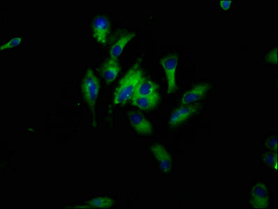 Immunofluorescence staining of Hela cells with HBEGF Antibody at 1:33, counter-stained with DAPI. The cells were fixed in 4% formaldehyde, permeabilized using 0.2% Triton X-100 and blocked in 10% normal Goat Serum. The cells were then incubated with the antibody overnight at 4°C. The secondary antibody was Alexa Fluor 488-congugated AffiniPure Goat Anti-Rabbit IgG(H+L).Rabbit anti-Human HBEGF Polyclonal Antibody