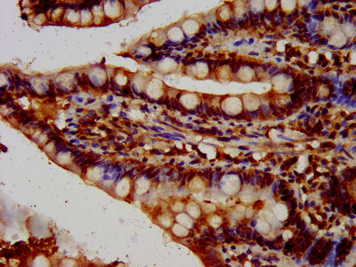IHC image of HBEGF Antibody diluted at 1:100 and staining in paraffin-embedded human small intestine tissue performed on a Leica BondTM system. After dewaxing and hydration, antigen retrieval was mediated by high pressure in a citrate buffer (pH 6.0). Section was blocked with 10% normal goat serum 30min at RT. Then primary antibody (1% BSA) was incubated at 4°C overnight. The primary is detected by a biotinylated secondary antibody and visualized using an HRP conjugated SP system.Rabbit anti-Human HBEGF Polyclonal Antibody