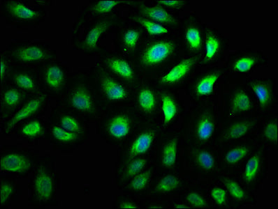 Immunofluorescence staining of A549 cells with MYO5A Antibody at 1:100, counter-stained with DAPI. The cells were fixed in 4% formaldehyde, permeabilized using 0.2% Triton X-100 and blocked in 10% normal Goat Serum. The cells were then incubated with the antibody overnight at 4°C. The secondary antibody was Alexa Fluor 488-congugated AffiniPure Goat Anti-Rabbit IgG(H+L).Rabbit anti-Human MYO5A Polyclonal Antibody