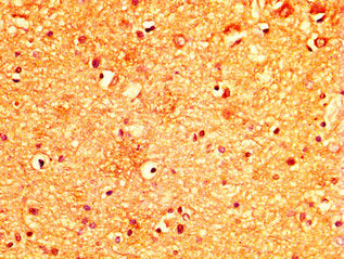 IHC image of MYO5A Antibody diluted at 1:300 and staining in paraffin-embedded human brain tissue performed on a Leica BondTM system. After dewaxing and hydration, antigen retrieval was mediated by high pressure in a citrate buffer (pH 6.0). Section was blocked with 10% normal goat serum 30min at RT. Then primary antibody (1% BSA) was incubated at 4°C overnight. The primary is detected by a biotinylated secondary antibody and visualized using an HRP conjugated SP system.Rabbit anti-Human MYO5A Polyclonal Antibody