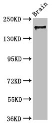 Western Blot | Positive WB detected in: Mouse brain tissue | All lanes: MYO5A antibody at 7.3μg/ml | Secondary | Goat polyclonal to rabbit IgG at 1/50000 dilution | Predicted band size: 216, 213, 219 kDa | Observed band size: 216 kDaRabbit anti-Human MYO5A Polyclonal Antibody