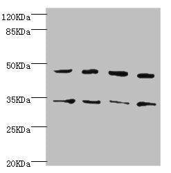 Western blot | All lanes: CYTH2 antibody at 5.58μg/ml | Lane 1: U251 whole cell lysate | Lane 2: HepG2 whole cell lysate | Lane 3: MCF-7 whole cell lysate | Lane 4: A549 whole cell lysate | Secondary | Goat polyclonal to rabbit IgG at 1/10000 dilution | Predicted band size: 47 kDa | Observed band size: 47, 35 kDaRabbit anti-Human CYTH2 Polyclonal Antibody