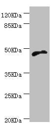 Western blot  | All lanes: CYTH2 antibody at 5.1µg/ml + MCF-7 whole cell lysate  | Secondary  | Goat polyclonal to rabbit IgG at 1/10000 dilution  | Predicted band size: 47 kDa  | Observed band size: 47 kDa