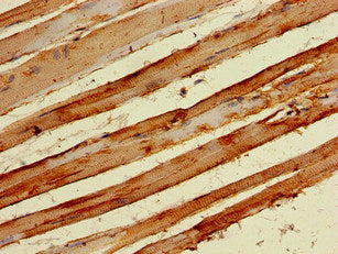 Immunohistochemistry of paraffin-embedded human skeletal muscle tissue using NPY6R Antibody at dilution of 1:100Rabbit anti-Human NPY6R Polyclonal Antibody