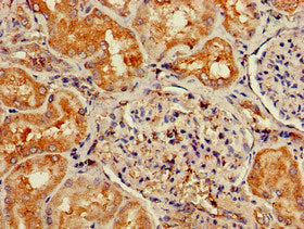 Immunohistochemistry of paraffin-embedded human kidney tissue using NPY6R Antibody at dilution of 1:100Rabbit anti-Human NPY6R Polyclonal Antibody