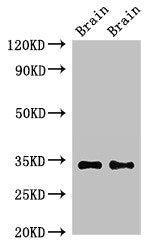 Western Blot | Positive WB detected in: Mouse brain tissue, Rat brain tissue | All lanes: NPY6R antibody at 2.3μg/ml | Secondary | Goat polyclonal to rabbit IgG at 1/50000 dilution | Predicted band size: 34 kDa | Observed band size: 34 kDaRabbit anti-Human NPY6R Polyclonal Antibody