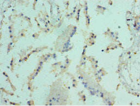 Immunohistochemistry of paraffin-embedded human prostate tissue using ELF4 Antibody at dilution of 1:100Rabbit anti-Human ELF4 Polyclonal Antibody