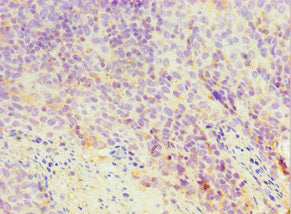 Immunohistochemistry of paraffin-embedded human tonsil tissue using TXN2 Antibody at dilution of 1:100Rabbit anti-Human TXN2 Polyclonal Antibody