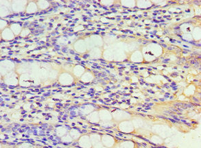 Immunohistochemistry of paraffin-embedded human colon tissue using TXN2 Antibody at dilution of 1:100Rabbit anti-Human TXN2 Polyclonal Antibody