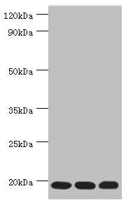 Western blot | All lanes: Thioredoxin, mitochondrial antibody at 3μg/ml | Lane 1: Mouse liver tissue | Lane 2: Rat brain tissue | Lane 3: Mouse kidney tissue | Secondary | Goat polyclonal to rabbit IgG at 1/10000 dilution | Predicted band size: 18 kDa | Observed band size: 18 kDaRabbit anti-Human TXN2 Polyclonal Antibody