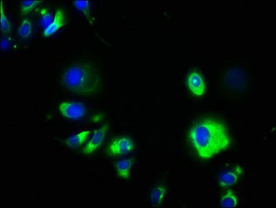 Immunofluorescence staining of MCF-7 cells with the antibody at 1:133, counter-stained with DAPI. The cells were fixed in 4% formaldehyde, permeabilized using 0.2% Triton X-100 and blocked in 10% normal Goat Serum. The cells were then incubated with the antibody overnight at 4°C. The secondary antibody was Alexa Fluor 488-congugated AffiniPure Goat Anti-Rabbit IgG(H+L).Rabbit anti-Human GPA33 Polyclonal Antibody