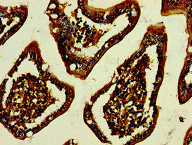 Immunohistochemistry of paraffin-embedded human small intestine tissue using GPA33 Antibody at dilution of 1:100Rabbit anti-Human GPA33 Polyclonal Antibody